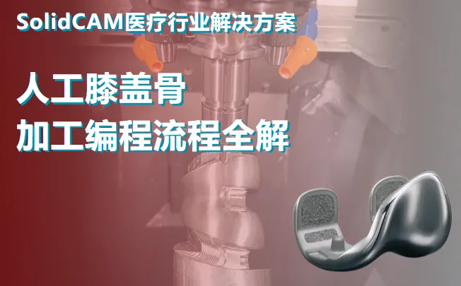 SolidCAM 医疗行业解决方案 | 人工膝盖骨加工编程流程全解